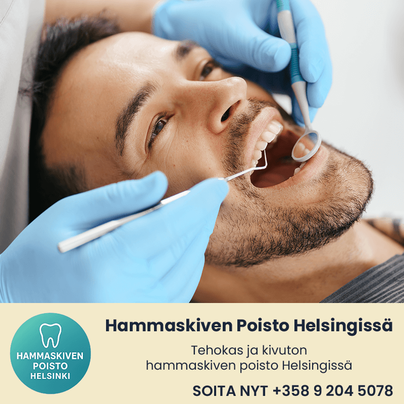 Hammaskiven Poisto Helsingissä